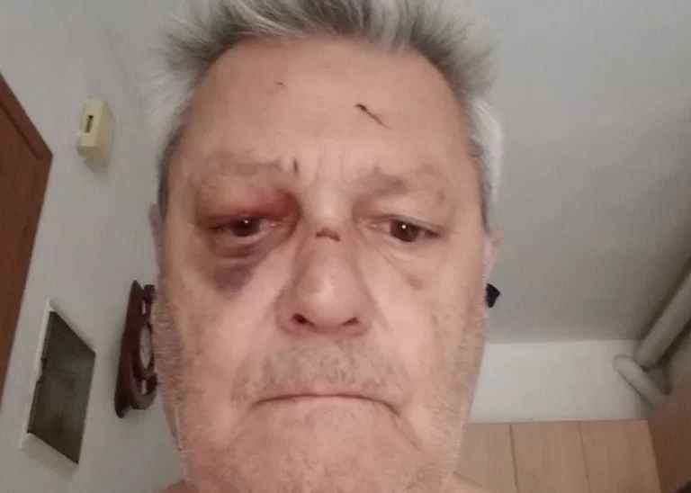 Ληστής γρονθοκόπησε 65χρονο και κλώτσησε το σκυλάκι του