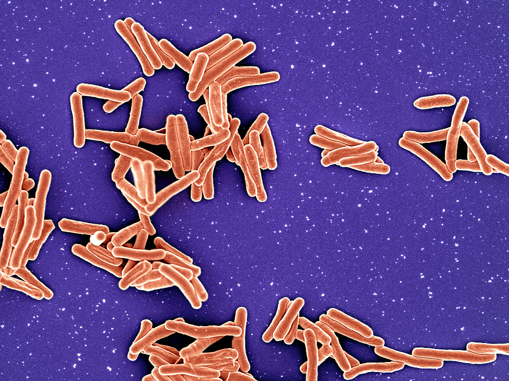 H φυματίωση προκαλείται από το βακτήριο Mycobacterium tuberculosis, εδώ σε εικόνα ηλεκτρονικού μικροσκοπίου (NIAID)