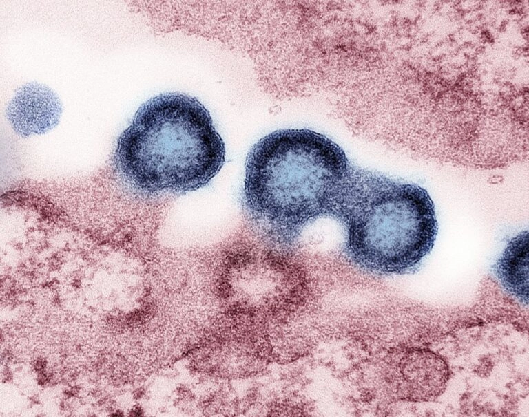PrEP: Το ισχυρότερο μέσο αναχαίτισης του HIV