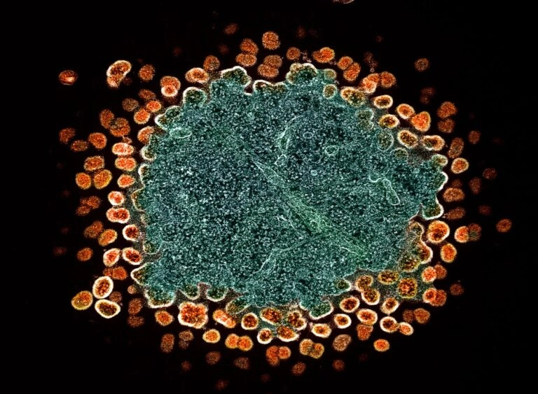 «Πράσινο φως» για πρόληψη του HIV με νέο φάρμακο και στην Ευρώπη