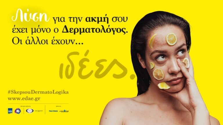 Λύση στην ακμή δίνει ο δερματολόγος – Οι υπόλοιποι έχουν ιδέες