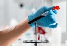 Φεριτίνη: Αυξάνονται τα όρια με στόχο να μειωθούν τα αδιάγνωστα περιστατικά αναιμίας